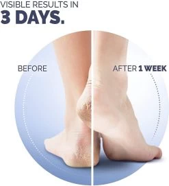 Scholl Klovenzalf - K+ Creme - Voor Hielkloven En Ruwe, Droge Huid -Manicure En Pedicure 1094x1200 1