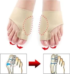 Hallux Valgus - Teenspreider - Teencorrector - Hallux Valgus Grote Teencorrector - Sok 2 Stuks