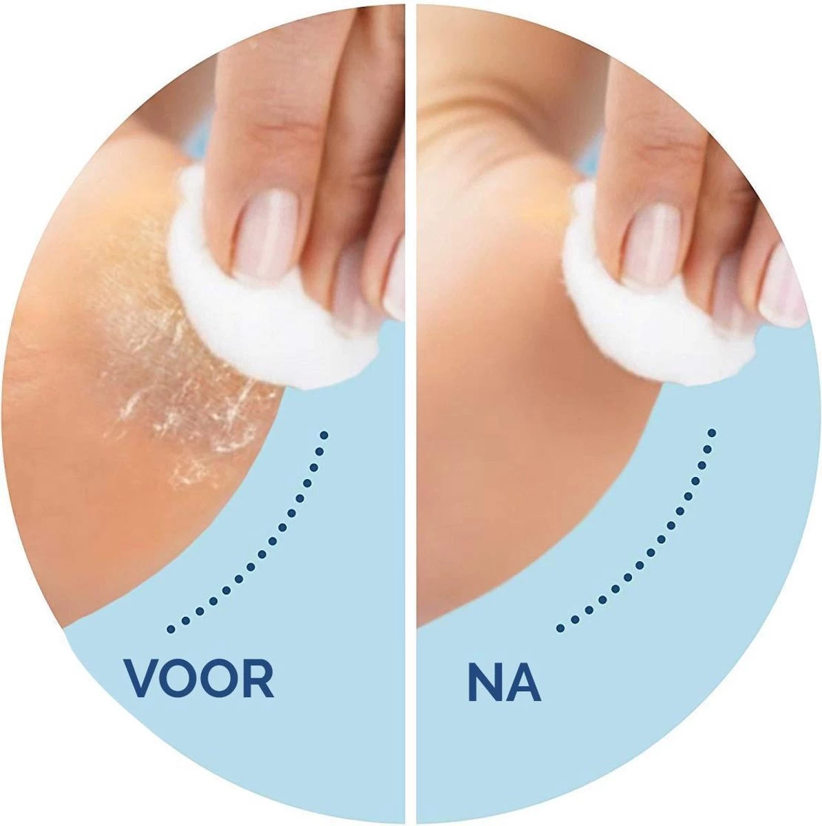 Scholl Velvet Smooth - Navulling Eeltverwijderaar - Regular - Voetvijl - 2 Stuks 3 Scholl Velvet Smooth - Navulling Eeltverwijderaar - Regular - Voetvijl - 2 Stuks - Afbeelding 3