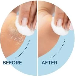 Scholl Velvet Smooth Voetvijl Wet & Dry - Starter - 1 Stuk 7 Scholl Velvet Smooth Voetvijl Wet & Dry - Starter - 1 Stuk -Manicure En Pedicure 1196x1200