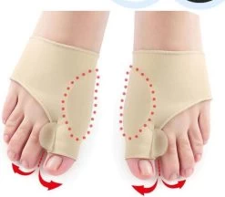 Merkloos Hallux Valgus Teen Spreider/Corrector Knobbel Teen Corrector |bunion | Eeltknobbel | Teen Rechtzetten | Comfortabel -Manicure En Pedicure 1200x1049
