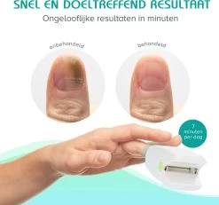 Anti Schimmelnagel Zelf-laserapparaat Incl. Pedicure Set 13 Anti Schimmelnagel Zelf-laserapparaat Incl. Pedicure Set -Manicure En Pedicure 1200x1120