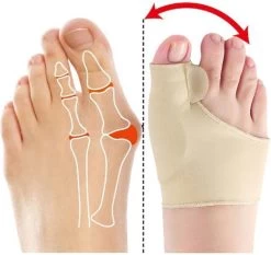 Hallux Valgus - Teenspreider - Teencorrector - Hallux Valgus Grote Teencorrector - Sok 2 Stuks -Manicure En Pedicure 1200x1133