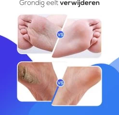 LifeWise Elektrische Eelt Verwijderaar - Voetvijl - 60 Vervangbare Schuurpads - Netstroom Adapter -Manicure En Pedicure 1200x1155 3