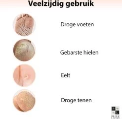 PureLuxure Voetmasker - Voetverzorging - Eeltsokken - Eelt Verwijderaar - Voetenmasker - Peel Off Masker - 1 Paar (2 Stuks) -Manicure En Pedicure 1200x1174