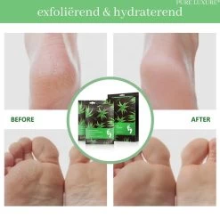 PureLuxure Voetmasker - Voetverzorging - Eeltsokken - Eelt Verwijderaar - Voetenmasker - Peel Off Masker - 1 Paar (2 Stuks) -Manicure En Pedicure 1200x1191 1