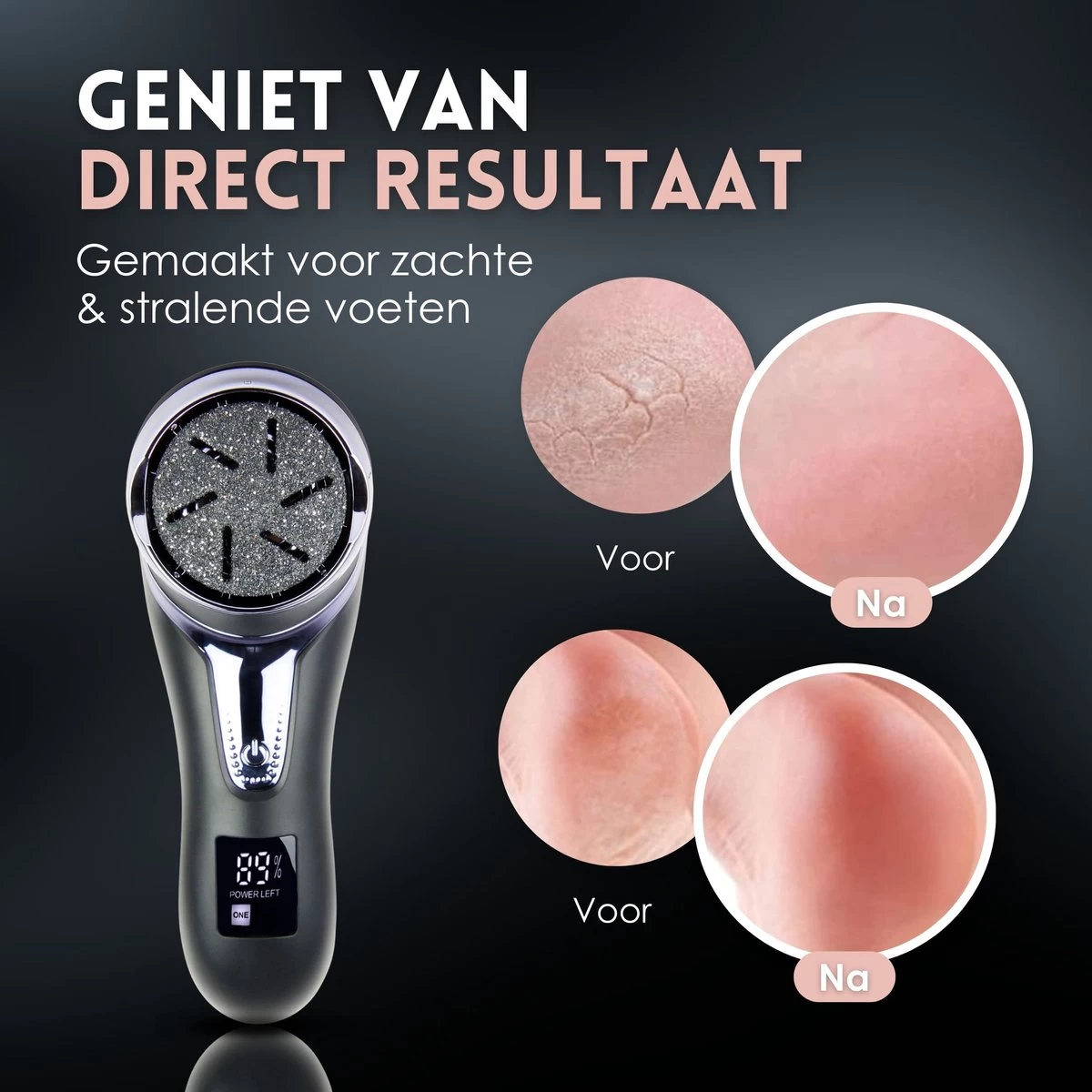 Beeperfect® Elektrische Eeltverwijderaar Met Stofzuigsysteem - Voetvijl - Eeltvijl - IPX7 Waterdicht - Gratis Pedicure Set - Zwart 3 Beeperfect® Elektrische Eeltverwijderaar Met Stofzuigsysteem - Voetvijl - Eeltvijl - IPX7 Waterdicht - Gratis Pedicure Set - Zwart - Afbeelding 3