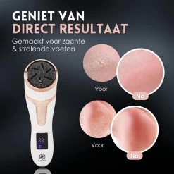 Beeperfect® Elektrische Eeltverwijderaar Met Stofzuigsysteem - Voetvijl - Eeltvijl - IPX7 Waterdicht - Gratis Pedicure Set -Manicure En Pedicure 1200x1200 153