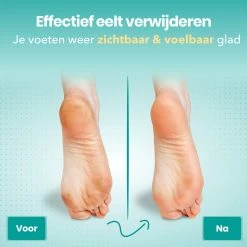 FreshDragon Elektrische Eelt Verwijderaar - Voetvijl - Inclusief 3 Rollers - Oplaadbaar -Manicure En Pedicure 1200x1200 205