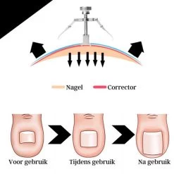 7-Delige Pedicure Set - Nagelverzorging - Nagelset - Ingegroeide Teennagel - Nagelknipper - Nail Clippers - Ingrown Toenail 25 7-Delige Pedicure Set - Nagelverzorging - Nagelset - Ingegroeide Teennagel - Nagelknipper - Nail Clippers - Ingrown Toenail -Manicure En Pedicure 1200x1200 356