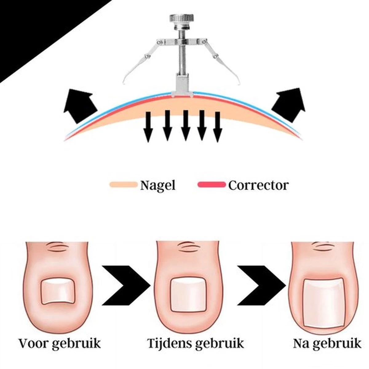 7-Delige Pedicure Set - Nagelverzorging - Nagelset - Ingegroeide Teennagel - Nagelknipper - Nail Clippers - Ingrown Toenail 12 7-Delige Pedicure Set - Nagelverzorging - Nagelset - Ingegroeide Teennagel - Nagelknipper - Nail Clippers - Ingrown Toenail - Afbeelding 12