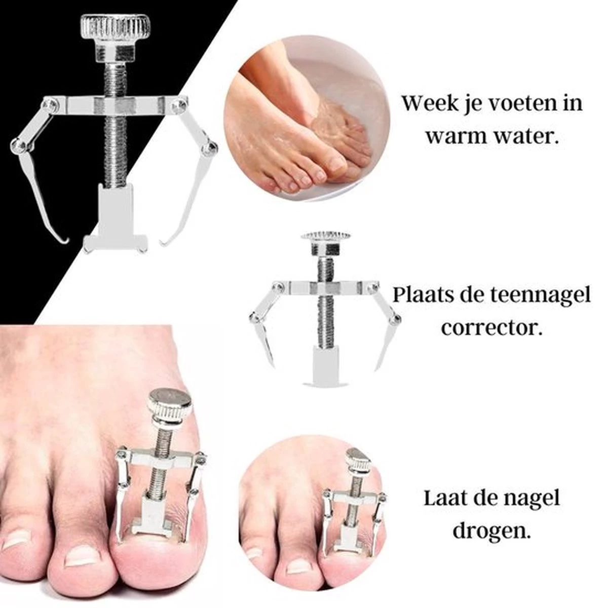 7-Delige Pedicure Set - Nagelverzorging - Nagelset - Ingegroeide Teennagel - Nagelknipper - Nail Clippers - Ingrown Toenail 14 7-Delige Pedicure Set - Nagelverzorging - Nagelset - Ingegroeide Teennagel - Nagelknipper - Nail Clippers - Ingrown Toenail - Afbeelding 14