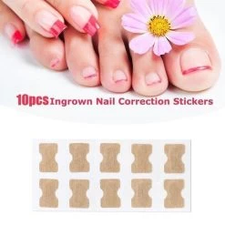 Merkloos Ingegroeide Teennagel Corrector -Manicure En Pedicure 1200x1200 61
