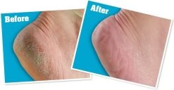 O'Keeffe's - Voetencreme - Voor Gezonde Voeten - Potje 96 Gram -Manicure En Pedicure 1200x622