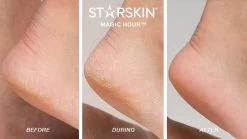 STARSKIN Exfoliating Magic Hour Eeltsokken Voet Masker - Eelt Verwijderaar - Baby Foot Peel Mask 9 STARSKIN Exfoliating Magic Hour Eeltsokken Voet Masker - Eelt Verwijderaar - Baby Foot Peel Mask -Manicure En Pedicure 1200x675 4
