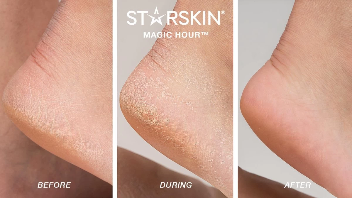 STARSKIN Exfoliating Magic Hour Eeltsokken Voet Masker - Eelt Verwijderaar - Baby Foot Peel Mask 3 STARSKIN Exfoliating Magic Hour Eeltsokken Voet Masker - Eelt Verwijderaar - Baby Foot Peel Mask - Afbeelding 3