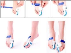 Hallux Valgus Statische Nachtspalk - Rechts + Links - Foot Pijnbestrijding - Teen Separator - Duim Corrector - Blauw / Wit -Manicure En Pedicure 1200x899 3