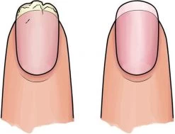 Herome 3 In 1 Manicure Nagelverzorging Set Blauw – Nagelset Voor Beschadigde Nagels - Nagelverharder, Nagellakremover En Nagelriemcreme - Set Van 3 -Manicure En Pedicure 1200x920