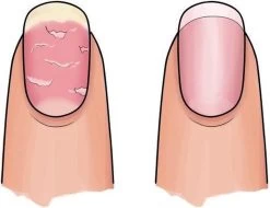 Herome 3 In 1 Manicure Nagelverzorging Set – Beschadigde Nagels – Nagelriemolie, Nagelriemcrème En Nagelverharder -Manicure En Pedicure 1200x925