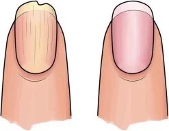 Herome 3 In 1 Manicure Nagelverzorging Set (Nail Essentials Geel) – Nagelset Voor Droge En Geribbelde Nagels – Base Coat, Vijl En Voedende Nagelolie – Voor Egale En Flexibele Nagels -Manicure En Pedicure 1200x926