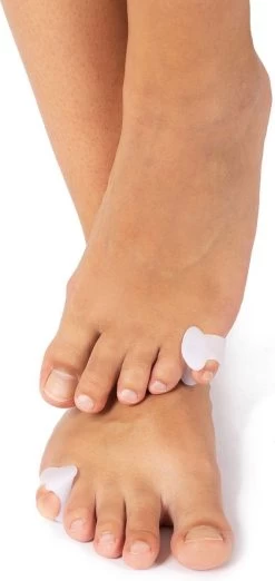 Solelution Kleine Teenspreider - Teencorrector - Per Paar